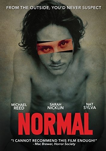 Normal - Normal