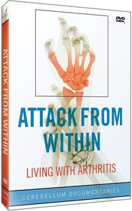 Attack From Within: Living With Arthritis