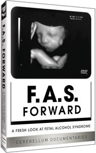 Fas Forward: Fresh Look at Fetal Alocohol